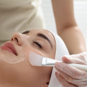 chemical peel for dark spots