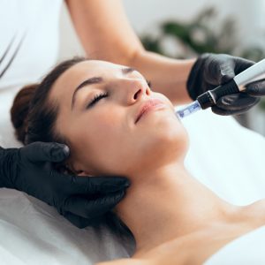 best microneedling denver