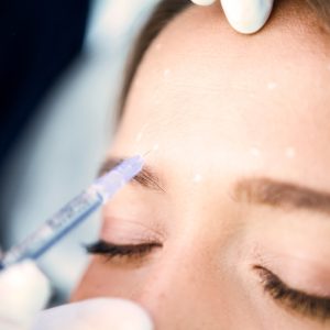 Botox treatment at Achieve Aesthetics in Lakewood