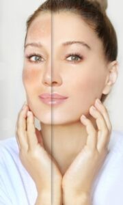 sun damage skin care