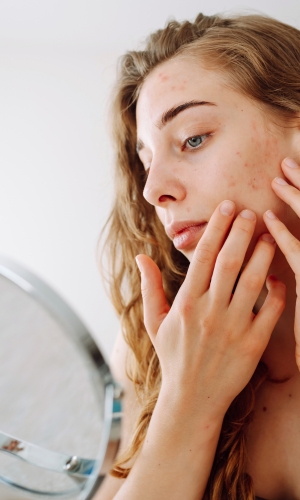 prp prf microneedling lakewood